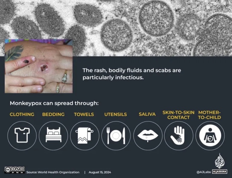 monkeypox