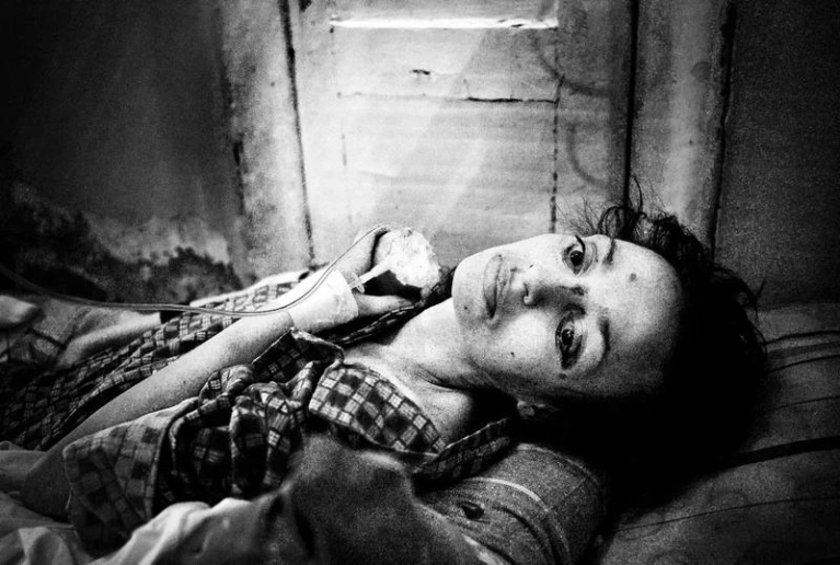Polina, 37, rests in a hospital bed in St. Petersburg, Russia, in 2011. She is severely malnourished and suffers from numerous diseases, including tuberculosis, hepatitis C and HIV. Misha Friedman