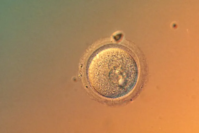 Scientists Edit Human Embryo Genes With Startling Precision