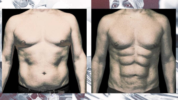 ab-implants.jpg