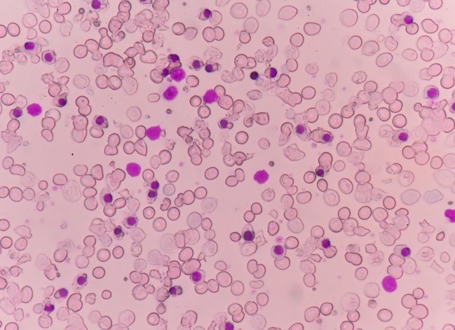 groopman-beta-thalassemia.jpg