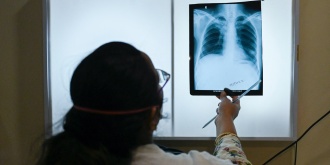 cetuberculosis000_326r8r3.jpg